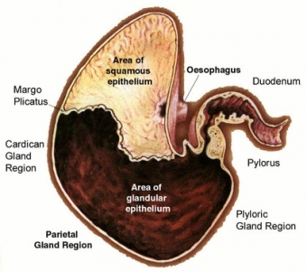 Gastric ul